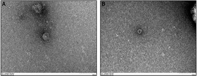 Analysis of Competitive Endogenous Mechanism and Survival Prognosis of Serum Exosomes in Ovarian Cancer Patients Based on Sequencing Technology and Bioinformatics